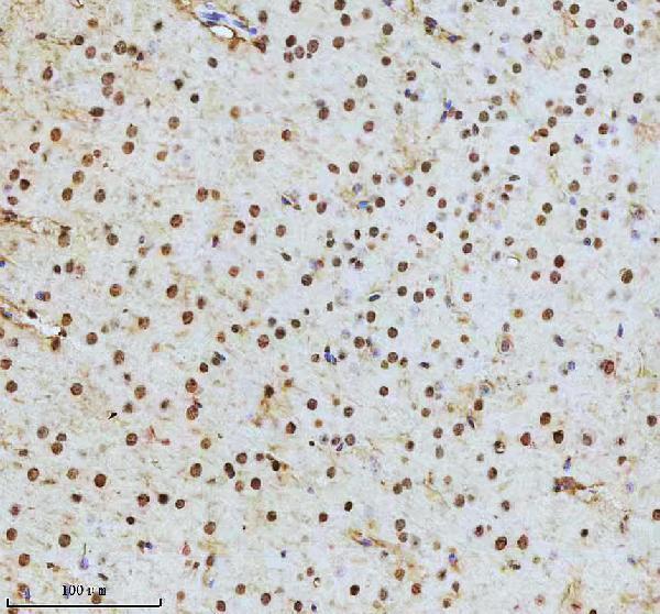 m00150 1 ptpn11 primary antibodies ihc testing 5