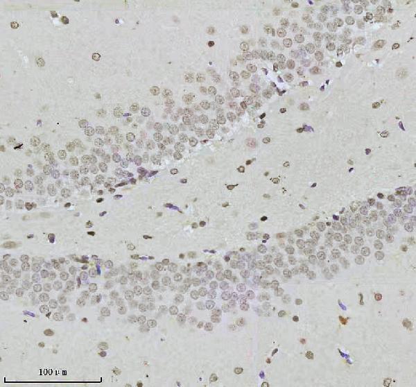 m00150 1 ptpn11 primary antibodies ihc testing 6