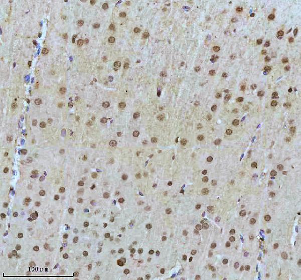 m00150 1 ptpn11 primary antibodies ihc testing 7