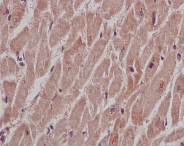 Immunohistochemical analysis of paraffin-embedded human heart, using SHP2 Antibody