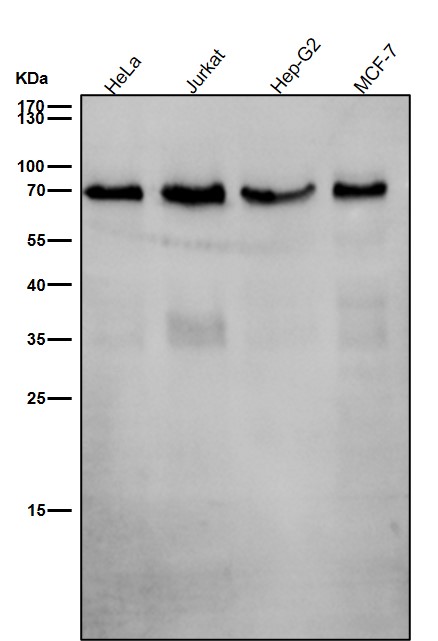All lanes use the Antibody at 1:1K dilution for 1 hour at room temperature