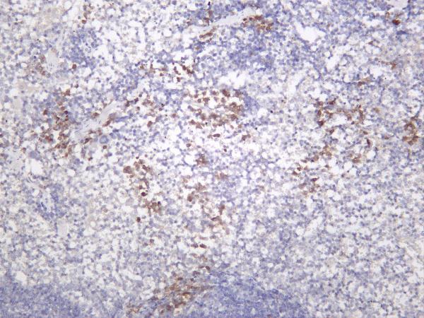 m00151 2 ptk2 primary antibodies ihc testing 1