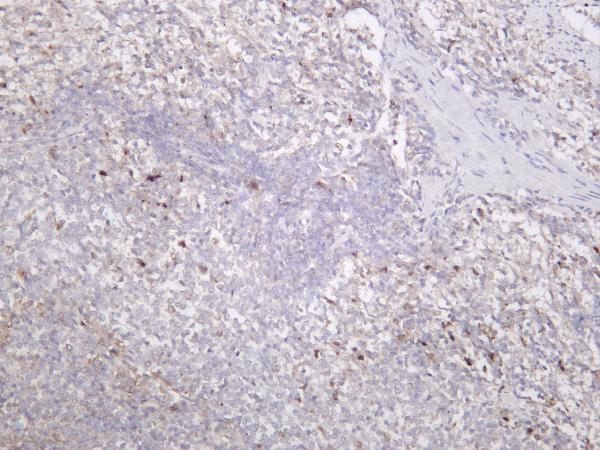 m00151 2 ptk2 primary antibodies ihc testing 2