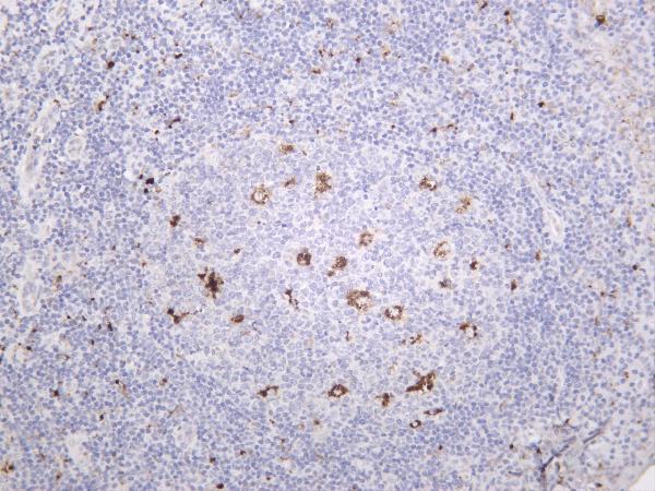 m00151 2 ptk2 primary antibodies ihc testing 3