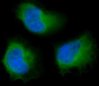 IF analysis of immunocytochemical section of HeLa cells using anti-FAK antibody (M00151) FAK was detected in immunocytochemical section. Enzyme antigen retrieval was performed using IHC enzyme antigen retrieval reagent (AR0022) for 15 mins. The tissue section was blocked with 10% goat serum. The tissue section was then incubated with 2μg/mL rabbit anti-FAK Antibody (M00151) overnight at 4 °C. DyLight®488 Conjugated Goat AntiRabbit IgG (BA1127) was used as secondary antibody at 1:100 dilution and incubated for 30 minutes at 37 °C. The section was counterstained with DAPI. Visualize using a fluorescence microscope and filter sets appropriate for the label used.