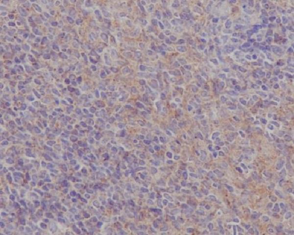 m00151 ihc