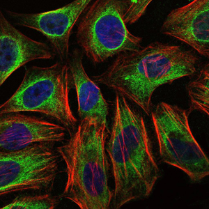Immunofluorescence analysis of Hela cells using Cbl Monoclonal Antibody (green)