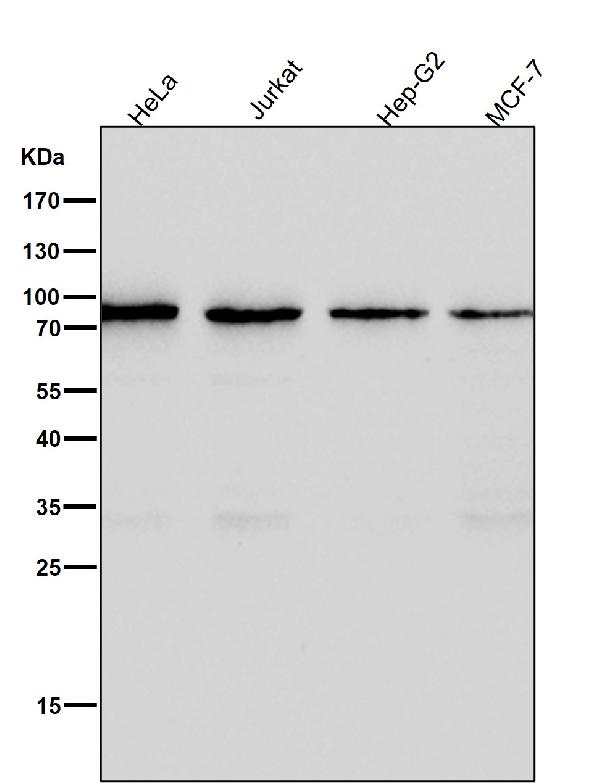 All lanes use the Antibody at 1:2K dilution for 1 hour at room temperature.