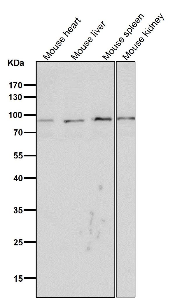 Western blot analysis of CD19 expression in (1) Jurkat cell lysate; (2) Rat spleen lysate. Western blot analysis of CD19 expression in (1) Jurkat cell lysate; (2) Rat spleen lysate.