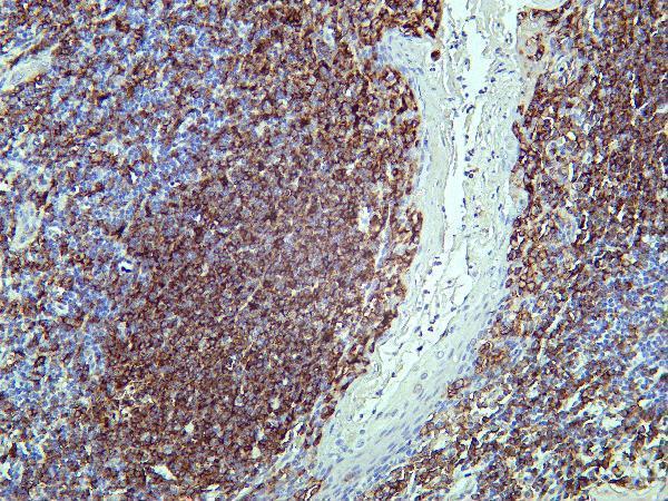 Human tonsil tissue was stained with Anti-CD19 rabbit Antibody