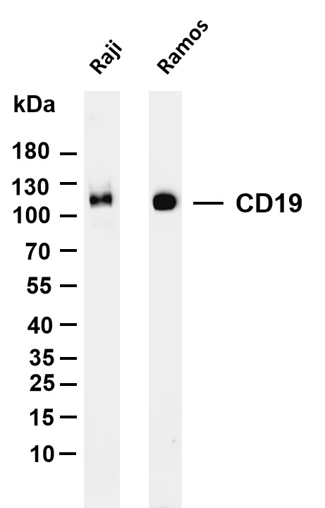 Various whole cell lysates were separated by 4-20% SDS-PAGE, and the membrane was blotted with anti-CD19 antibody