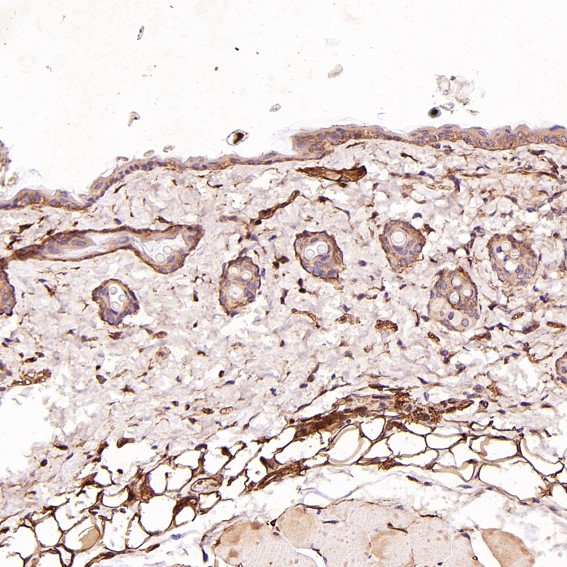 Immunohistochemical analysis of paraffin-embedded Rat stomach, using the Antibody at 1:100 dilution. Immunohistochemical analysis of paraffin-embedded Rat stomach, using the Antibody at 1:100 dilution.