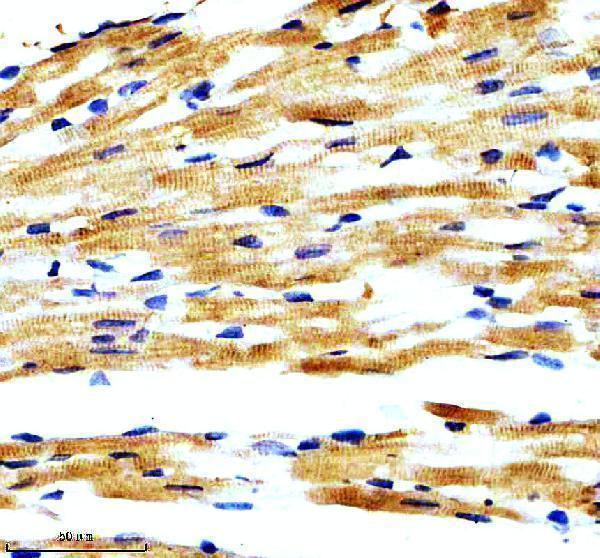 IHC analysis of RYR2 using anti-RYR2 antibody (M00155)