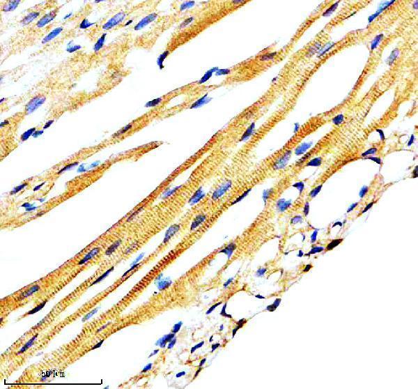 IHC analysis of RYR2 using anti-RYR2 antibody (M00155)