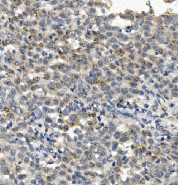 m00158 1 ccr2 primary antibodies ihc testing 2