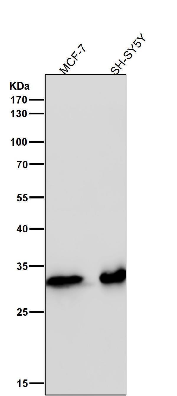 All lanes use the Antibody at 1:2K dilution for 1 hour at room temperature