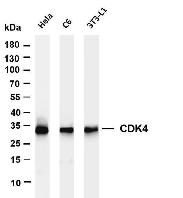 Various whole cell lysates were separated by 4-20% SDS-PAGE, and the membrane was blotted with anti-CDK4 antibody