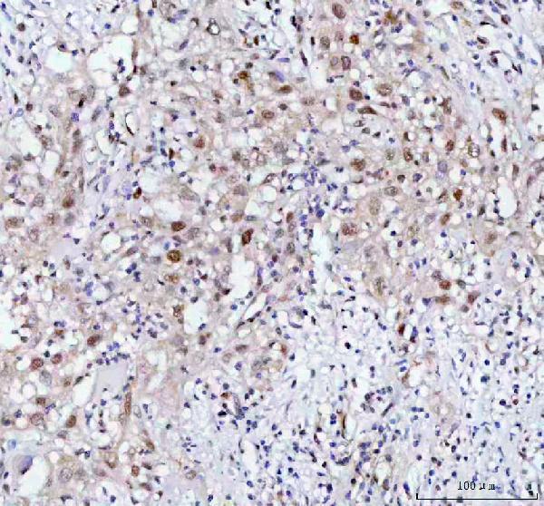 m00160 prc1 primary antibodies ihc testing 2