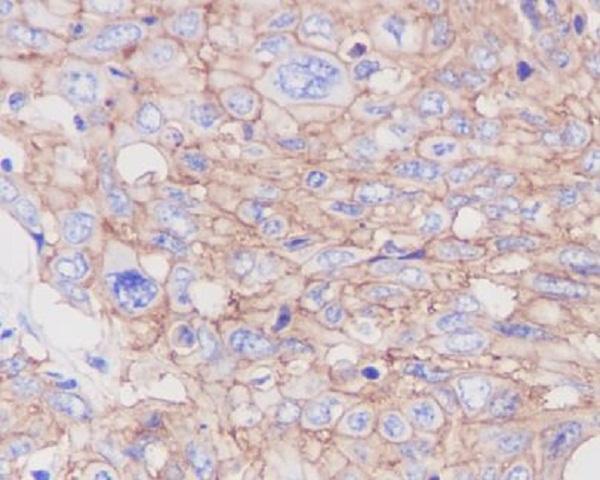 m00163 ihc