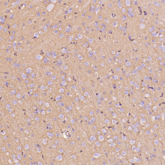 Immunohistochemical analysis of paraffin-embedded Rat hippocampus , using the Antibody at 1:300 dilution