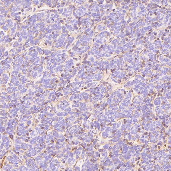 m00163 ihc8