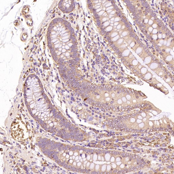 m00163 ihc9