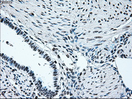 Immunohistochemical staining of paraffin-embedded endometrium tissue within the normal limits using anti-IRF3mouse monoclonal antibody