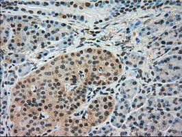 Immunohistochemical staining of paraffin-embedded Human pancreas tissue within the normal limits using anti-IRF3 mouse monoclonal antibody