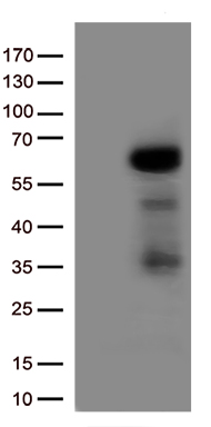 HEK293T cells were transfected with the pCMV6-ENTRY control (Left lane) or pCMV6-ENTRY IRF3 (Right lane) cDNA for 48 hrs and lysed