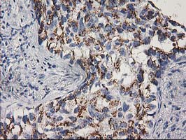 m00166 2 anti cdk2 mouse monoclonal antibody clone id oti2d9 ihc testing 5