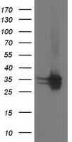 HEK293T cells were transfected with the pCMV6-ENTRY control (Left lane) or pCMV6-ENTRY CDK2 (Right lane) cDNA for 48 hrs and lysed