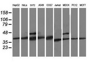 Western blot analysis of extracts (35ug) from 9 different cell lines by using anti-CDK2 monoclonal antibody