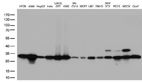 Western blot analysis of extracts (35ug) from 14 cell lines by using anti-CDK2 monoclonal antibody (1:500)
