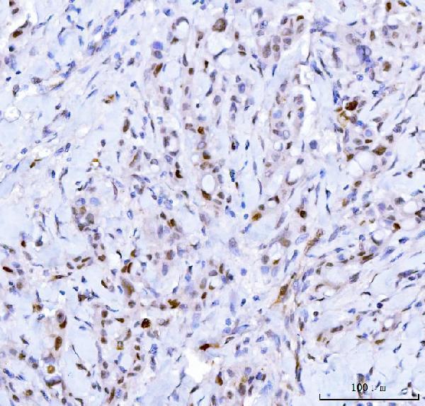  IHC analysis of Cdk2 using anti-Cdk2 antibody (M00166-3)