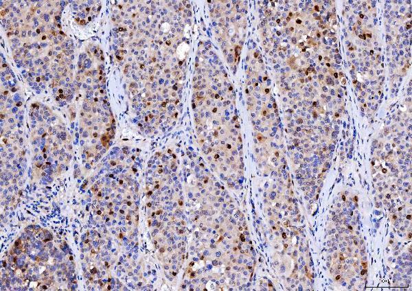 m00166 3 cdk2 primary antibodies ihc testing 4