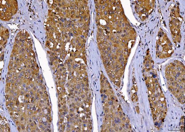  IHC analysis of Cdk2 using anti-Cdk2 antibody (M00166-4)