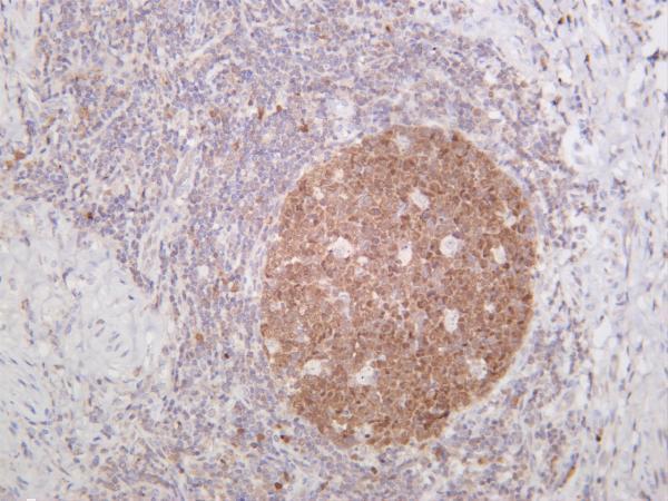 Human tonsil was stained with anti-CDK2 rabbit antibody