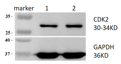 m00166 cdk2 primary antibodies wb review 1