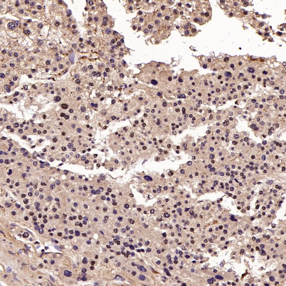 m00166 ihc10