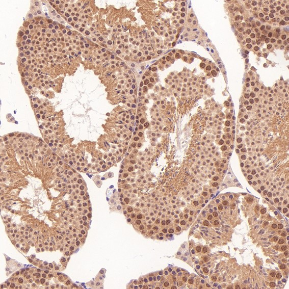 m00166 ihc11