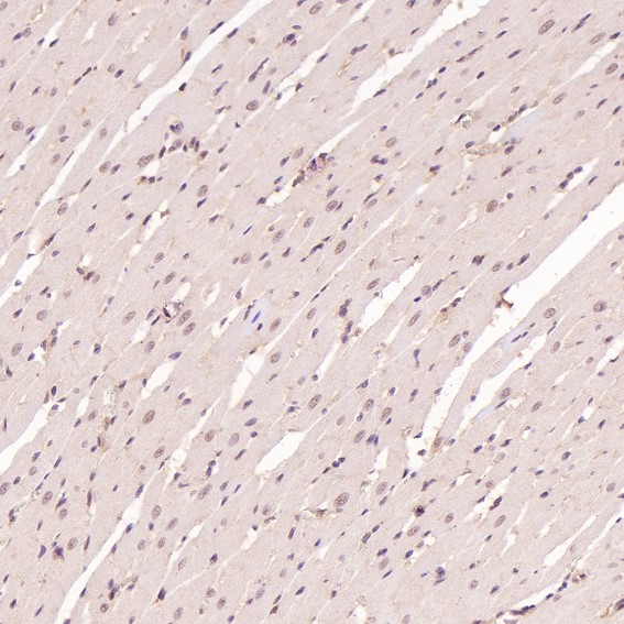Immunohistochemical analysis of paraffin-embedded Rat heart, using the Antibody at 1:200 dilution