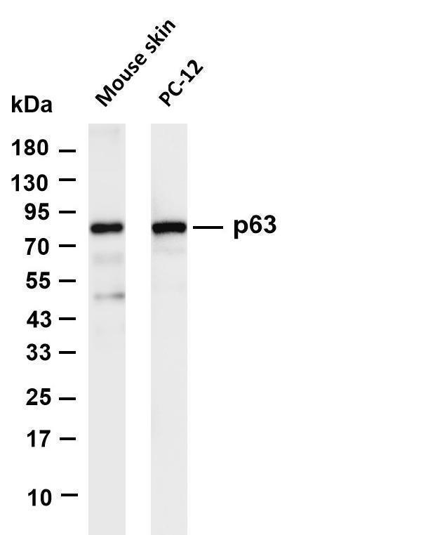 Various whole cell lysates were separated by 4-20% SDS-PAGE, and the membrane was blotted with anti-p63 antibody