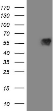 HEK293T cells were transfected with the pCMV6-ENTRY control (Left lane) or pCMV6-ENTRY MAVS (Right lane) cDNA for 48 hrs and lysed