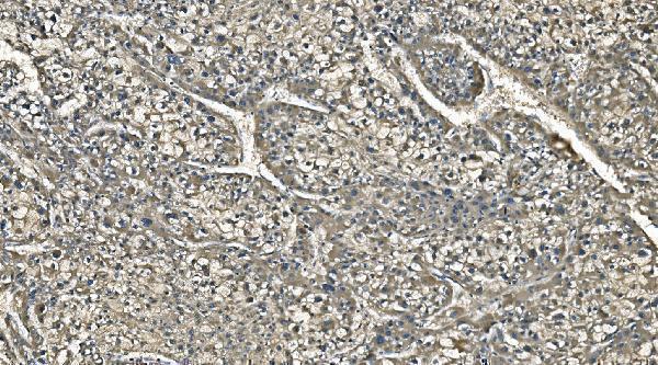 m00170 1 ca1 primary antibodies ihc testing 3