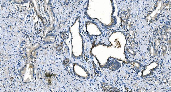 m00170 1 ca1 primary antibodies ihc testing 5