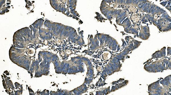 m00170 1 ca1 primary antibodies ihc testing 6