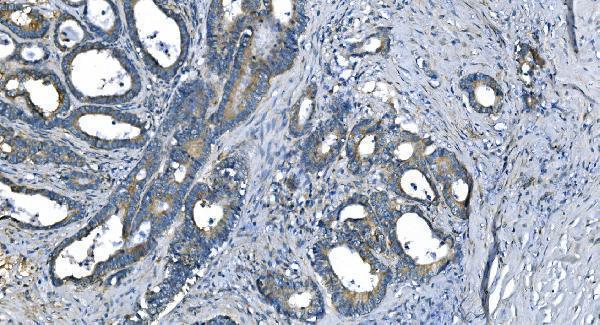 m00170 2 ca1 primary antibodies ihc testing 2