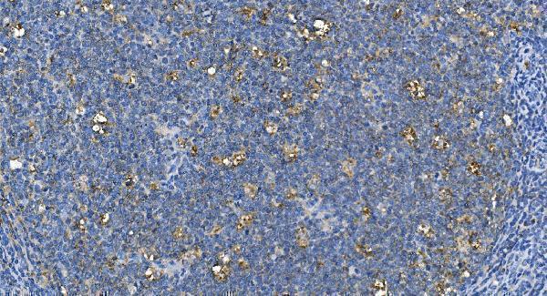 m00170 2 ca1 primary antibodies ihc testing 7