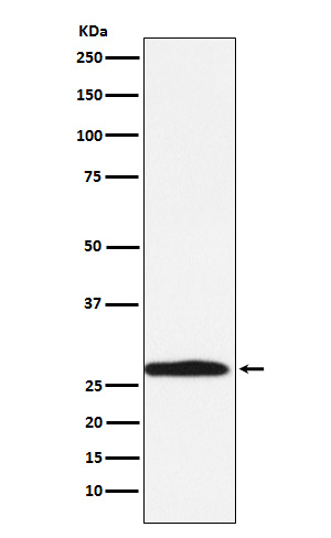 Western blot analysis of Carbonic Anhydrase 1 expression in K562 cell lysate