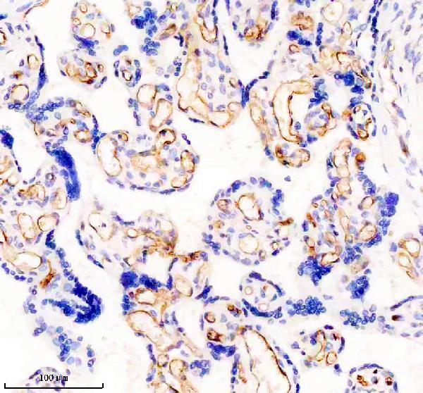 IHC analysis of ICAM1 using anti-ICAM1 antibody (M00171-1)